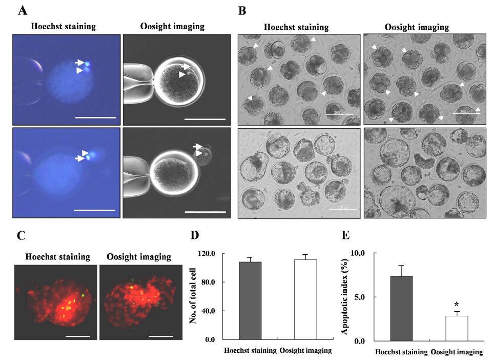 Oosight Imaging system을 이용한 체세포핵이식 복제 수정란 생산