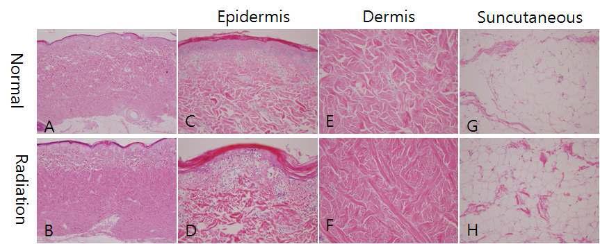 방사선 피폭 8주후 피부 조직 변화