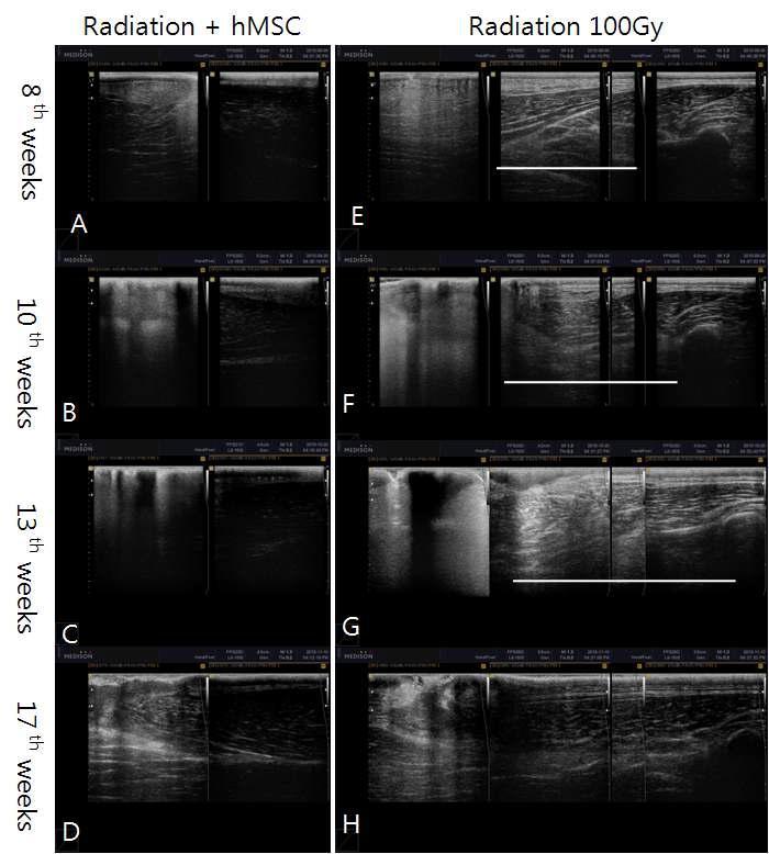 방사선 단독군과 hUCB-MSCs 투여군 초음파 소견