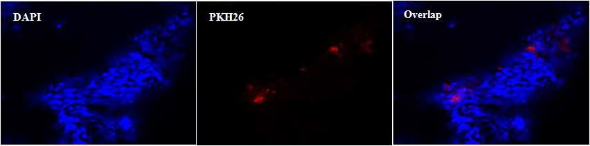 PKH-26 형광세포링커로 형광 표지를 한 hUCB-MSCs 폐장에서 발현 확인