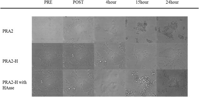 시간에 따른 PRA2, PRA2-H의 세포 morphology 변화를 확인