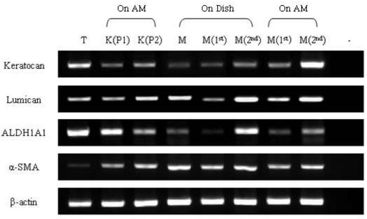 각막간질세포와 중배엽 줄기세포 특이적 표지 유전자에 대한 RT-PCR 분석.
