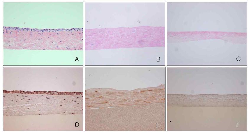 대조군 소양막 (A, D) 과 동결-해동-원심분리 무세포처리된 소양막 (B, E), 화학 효소적 무세포 처리된 소양막 (C, F)의 H&E 염색 (A, B, C) 과 bFGF 면역조직화학염색 (D, E, F) 소견.