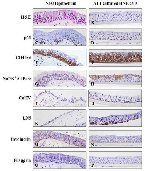 Comparative expressions of differentiation or polarity markers between intact nasal epithelium and ALI-cultured HNE cells onto 12 mm millicell.