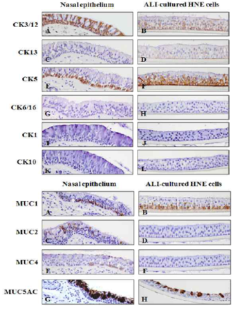 Comparative expressions of cytokeratins and mucins between intact nasal epithelium and ALI-cultured HNE cells onto 12 mm millicell.