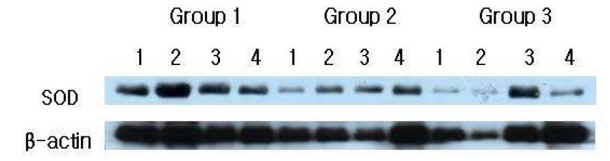 SOD Western analysis showing 4 representative samples in each group.