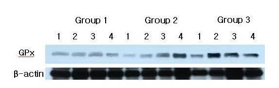 GPx western analysis showing 4 representative samples in each group. GPx levels were quantified on the basis of β-actin levels.