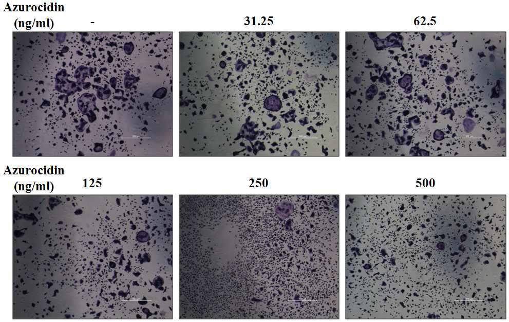 azrurocidin에 의한 파골세포 분화의 저해