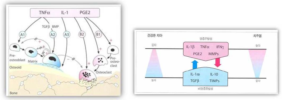 건강한 치아와 치주염에서 Cytokines과 matrix degradation에 관계된 효소의 균형을 도식화 함