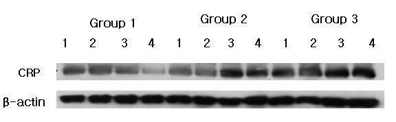 CRP Western analysis showing 4 representative samples in each group.