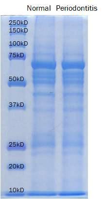 Flow chart of GCF (left), profile of pooling samples (middle), and SDS-PAGE image after coomassie blue staining (right)