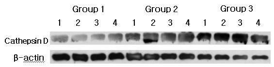 Cathepsin D western analysis showing 4 representative samples in each group.