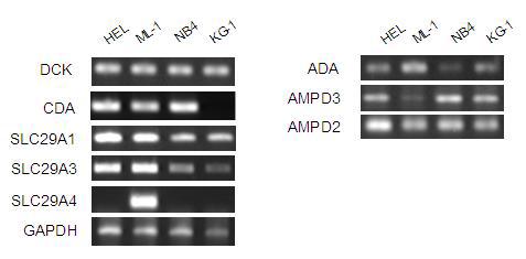 Expression levels of Ara-C metabolism related genes in human leukemia cell lines.