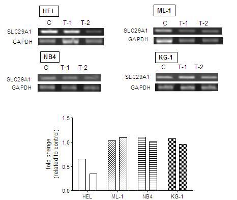 SLC29A1 expression in AML cells surviving Ara-C treatment