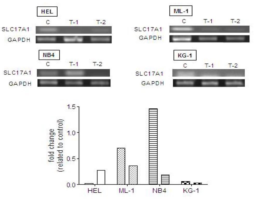 SLC17A1 expression in AML cells surviving Ara-C treatment