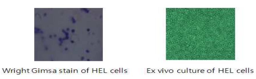 Re-growth of HEL cells following Ara-C treatment in AML animal model