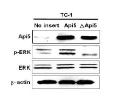 API5 과발현에 따른 ERK활성 비교.