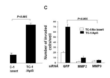 Matrigel를 이용한 TC-1/API5내의 MMP2과 MMP9 발현저하에 따른 전이능 확인.