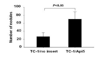 TC-1/API5 세포주의 생체내 암 전이능 증가.