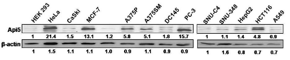 다양한 인간유래의 암세포주에서의 API5의 발현 양상.