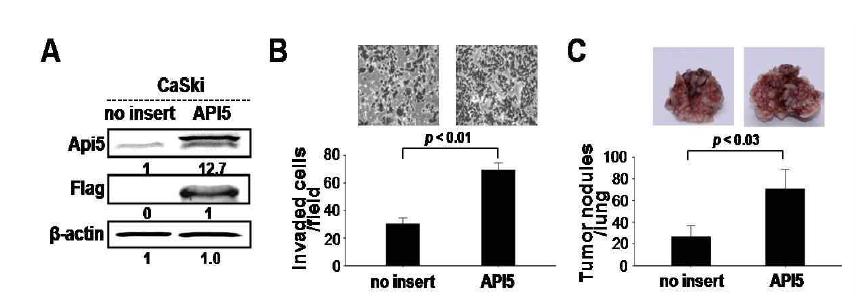 인간 자궁경부암 caski 세포주에서의 API5발현 증가에 따른 세포의 침윤능 증가 및 전이능 증가.