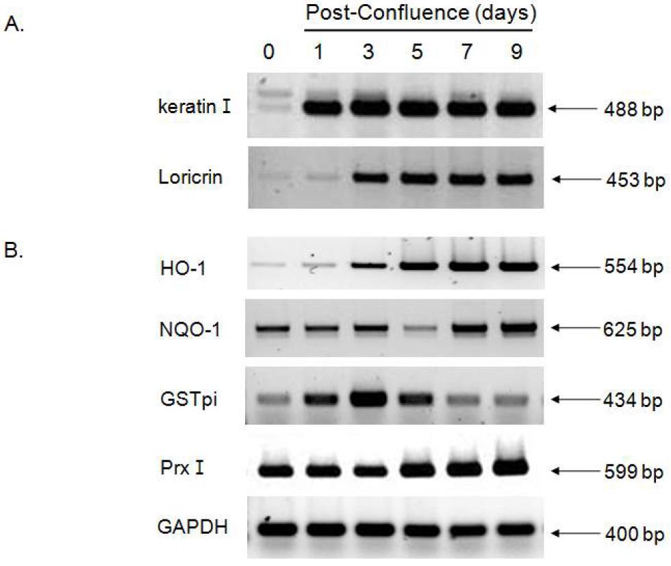 그림 11). HKs 세포에서 분화 유도 (9일)후 분화 마커 (K1, Loricrin)와 항산화 효소 mRNA 발현을 RT-PCR로 분석