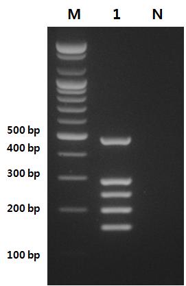 PCR detection of 5 different Vibrio spp. using multiplex PCR