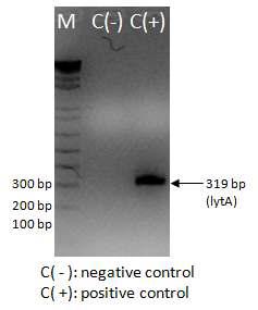 lytA PCR result from ear fluid samples