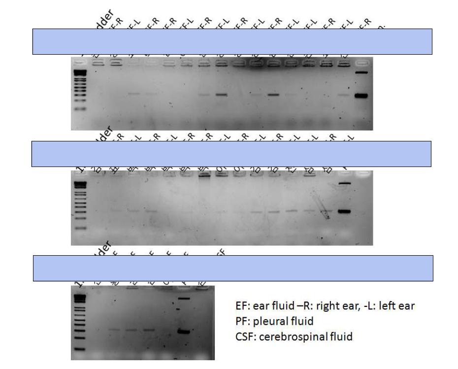 PCR result from lytA-PCR assay