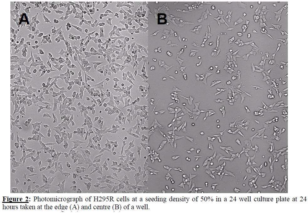 24 well 배양 플레이트에서 24시간 배양하여 50% 세포밀도 일 때 찍은 H295R 세포의 현미경 사진. 가장자리 (A) 중앙 (B)
