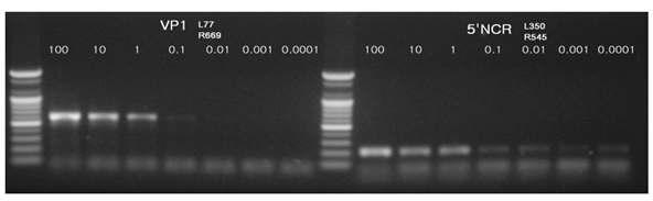 HAV RT-PCR