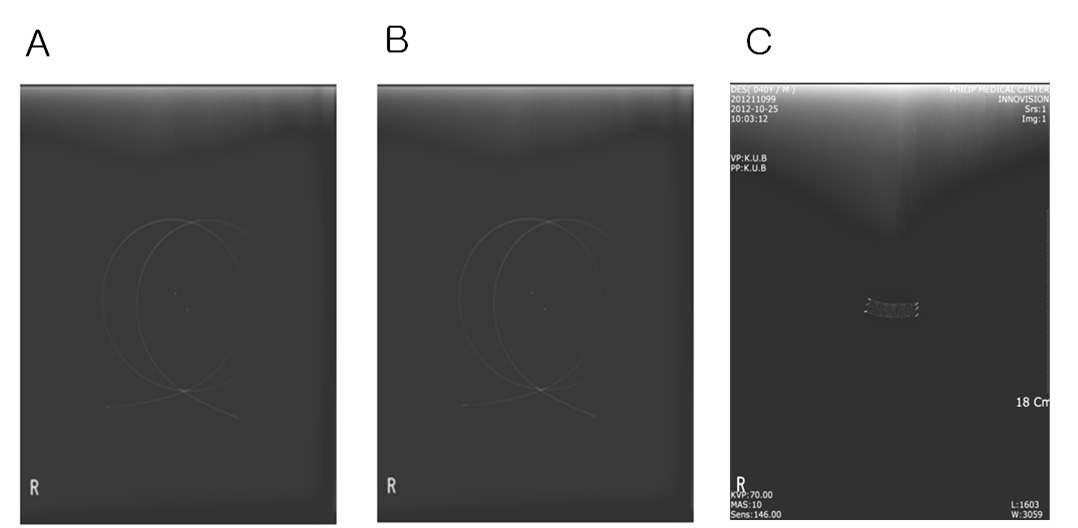 방사선불투과성 시험 결과A: A sample, B: B sample, C: C sample