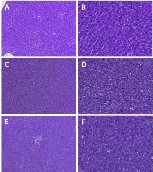 Histopathological change of female and male rats treated with Atracylodes macrocephala Koidzumi (A, B: control; C, D: female 4g/kg; E, F: male 4g/kg) 【A,C, E(50X), B, D, F(200X)】