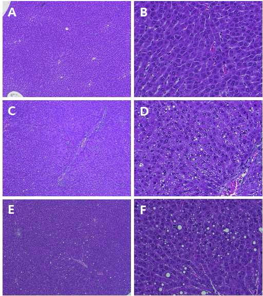 Histopathological change of female and male rats treated with Atracylodes macrocephala Koidzumi for 14 days (control: A, B, female 2g/kg: C, D, male 2g/kg : E, F) 【A,C, E(50X), B, D, F(200X)】