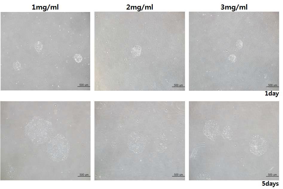 여러 농도의 Matrigel에서 인간 배아줄기세포 배양