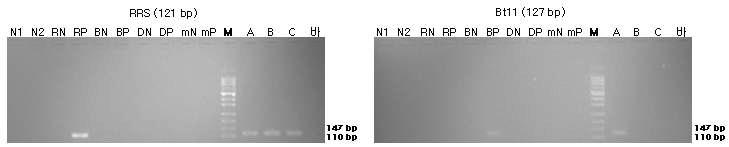 표준시료의 구조유전자 (RRS과 Bt11)의 정성 PCR 분석 결과를 전기영동한 이미지