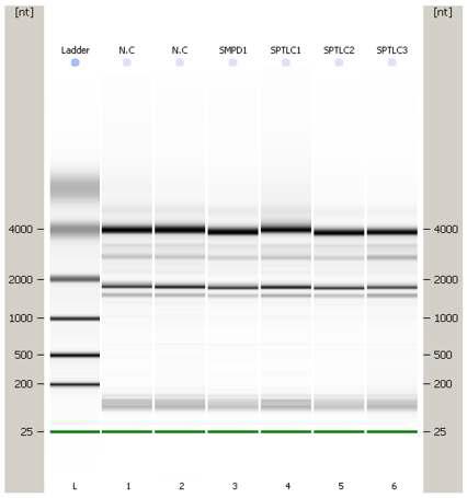 Microarray 용 RNA 추출 결과