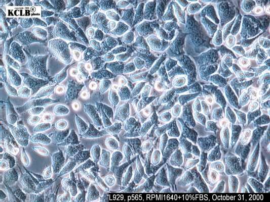 L929 세포의 배양 후 현미경 사진 (한국세포주은행 제공)