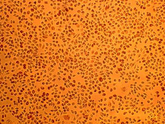 뉴트럴 레드 용액으로 염색한 세포의 현미경 사진