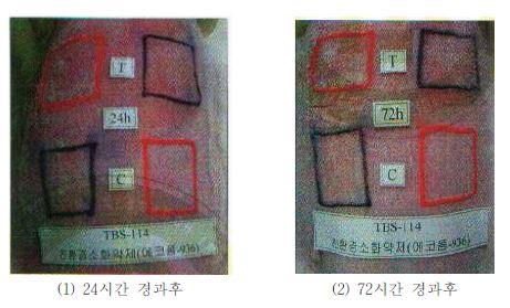 피부 자극 시험 모습