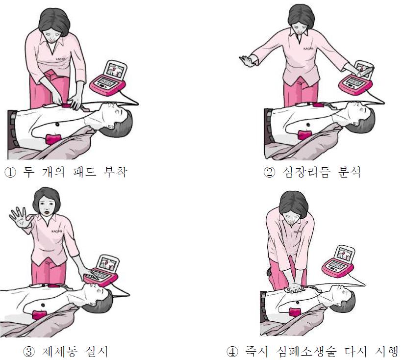 자동제세동기 사용 방법