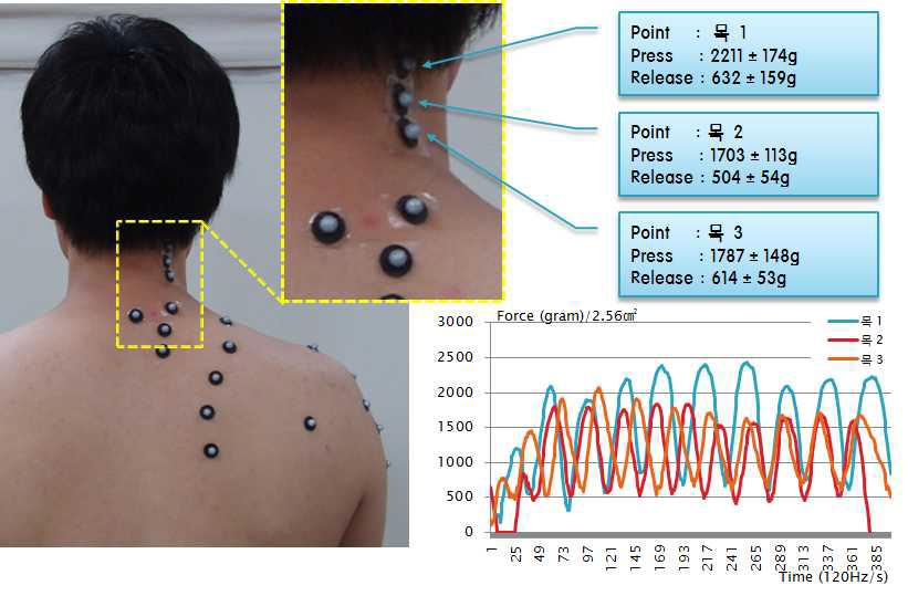 견갑거근의 마사지 위치 및 가압력 그래프