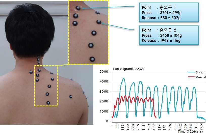 승모근의 마사지 위치 및 가압력 그래프