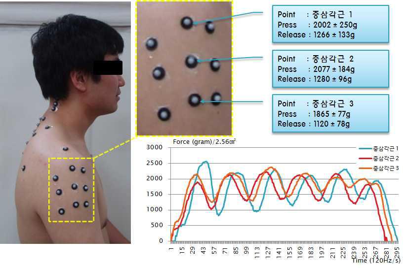 중삼각근의 마사지 위치 및 가압력 그래프