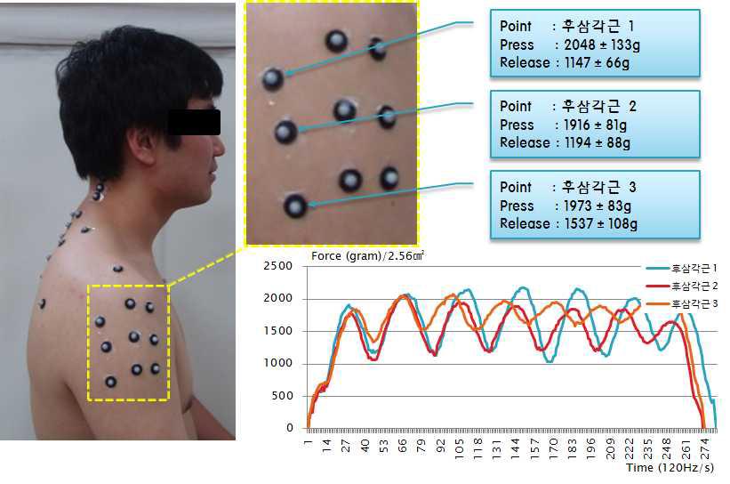 후삼각근의 마사지 위치 및 가압력 그래프
