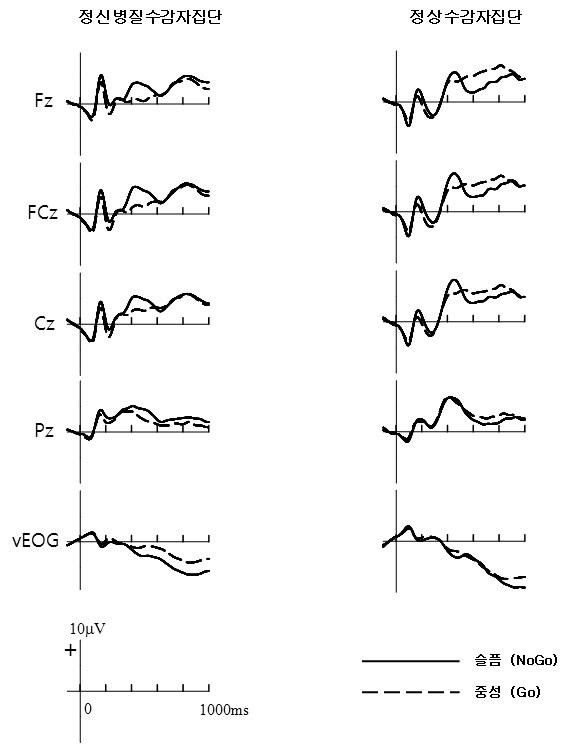 그림 3 슬픔, 중성 표정자극 유형에 따른 정신병질 수감자집단과 정상 수감자집단의 전체평균 사건관련전위