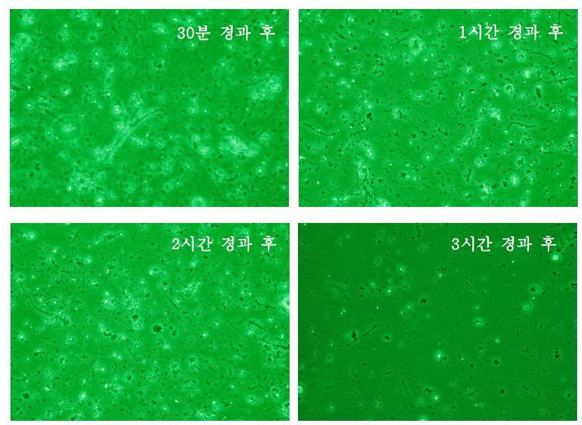 슬레이트 조각으로부터 비산된 석면에 대한 위상차현미경관찰