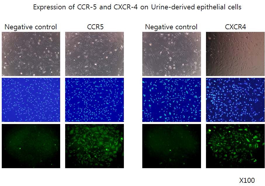 그림. human Urine-derived epithelial cell에서 CCR5 및 CXCR4 발현 확인(Immunocytochemistry)