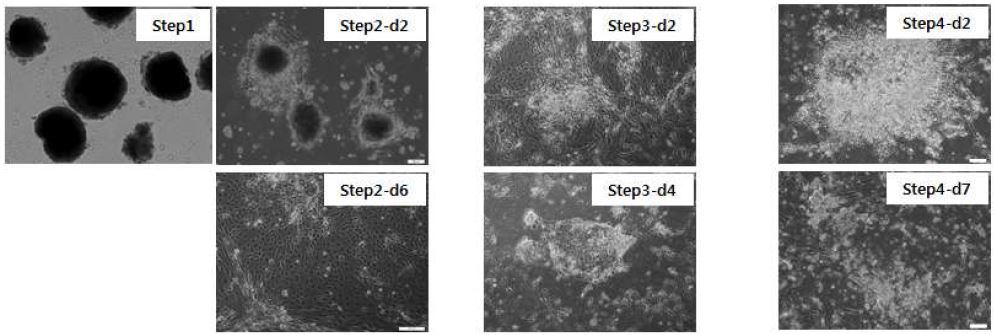 그림. #1 protocol에 따른 배아줄기세포의 조혈줄기세포 분화 단계별 현미경 이미지