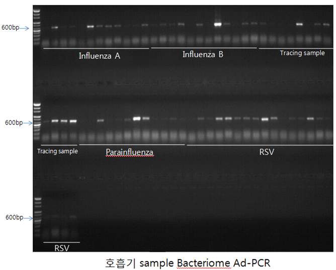 세균 메타게놈 라이브러리 제작을 위한 Ad-PCR product의 gel-image